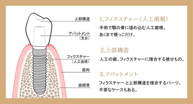 食事をしっかりと噛める第二の歯　イメージ写真