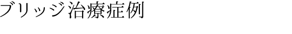 ブリッジ治療症例