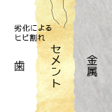 セメント治療　イメージ図