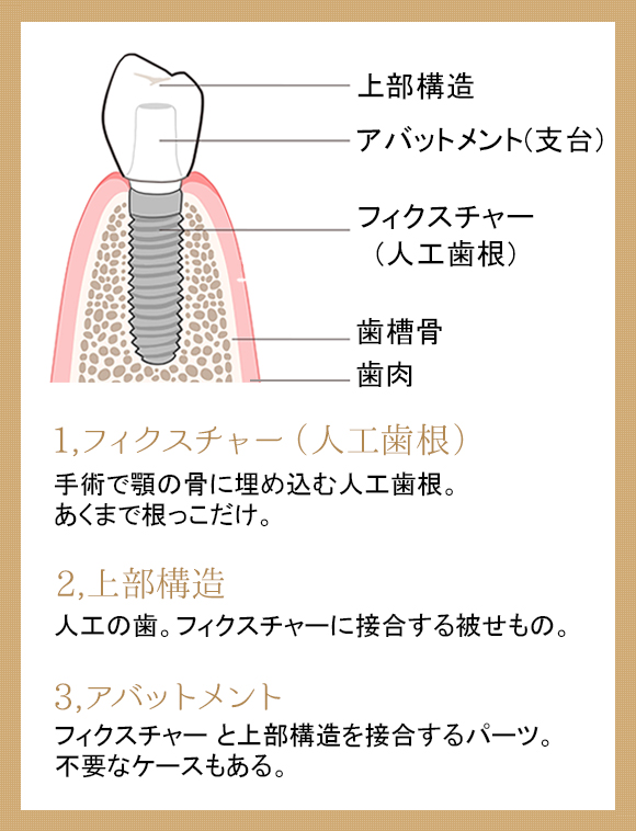 食事をしっかりと噛める第二の歯　イメージ写真